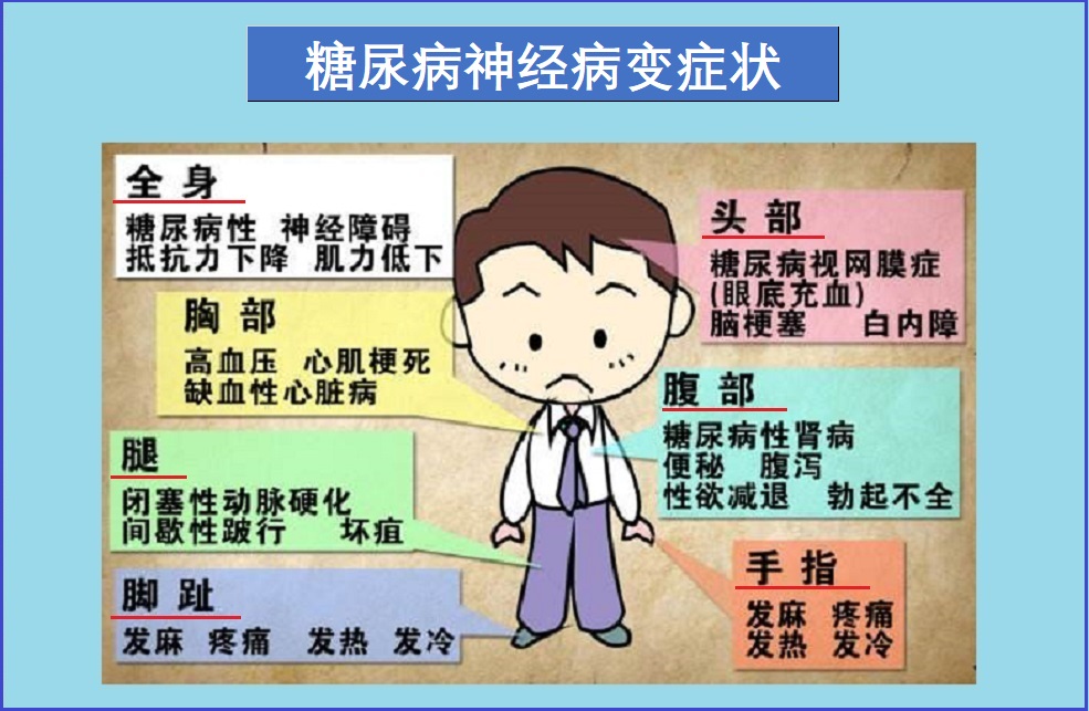  糖尿病神经病变