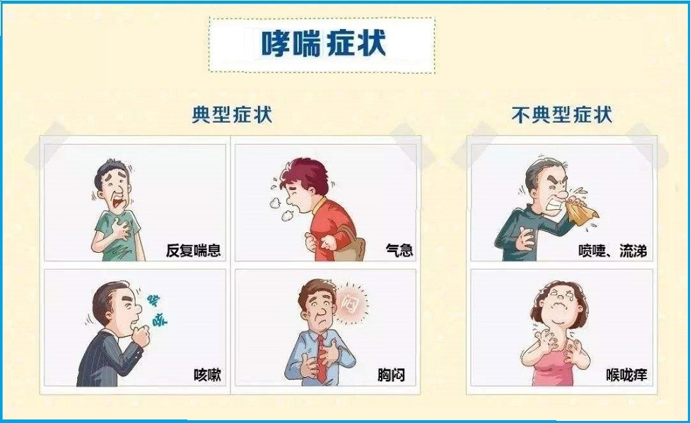  哮喘