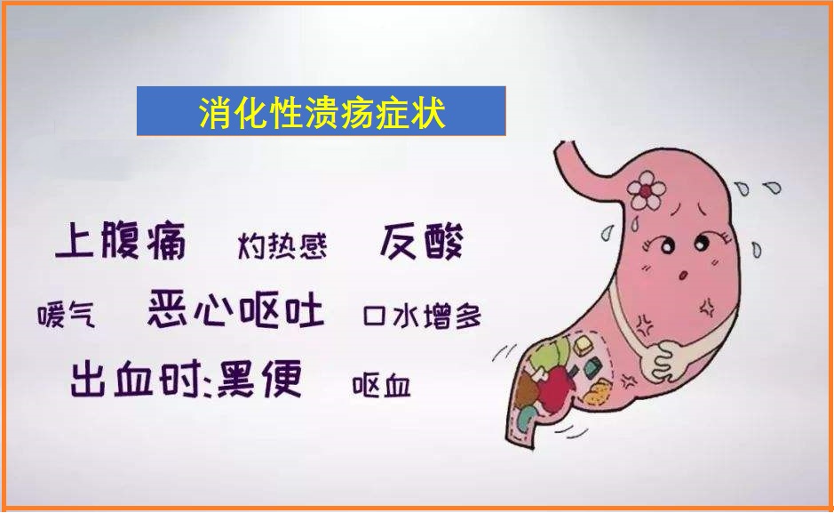  消化性溃疡