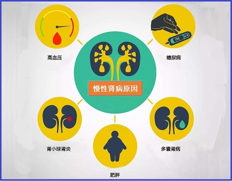  肾病综合征