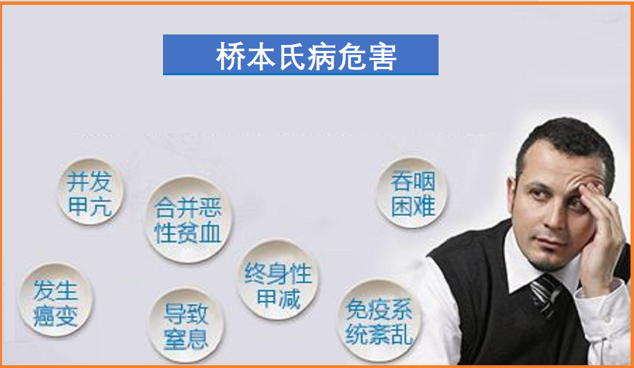  桥本氏甲状腺炎
