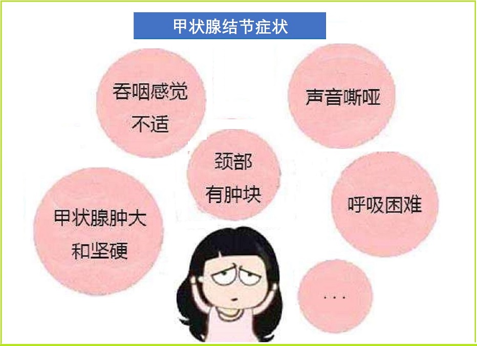  甲状腺结节