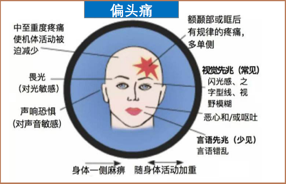  偏头痛