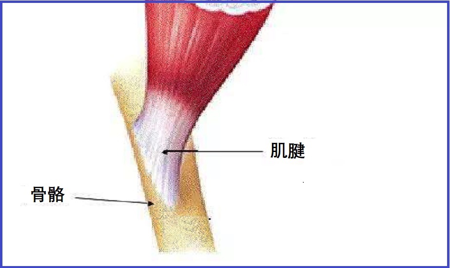  肌腱病