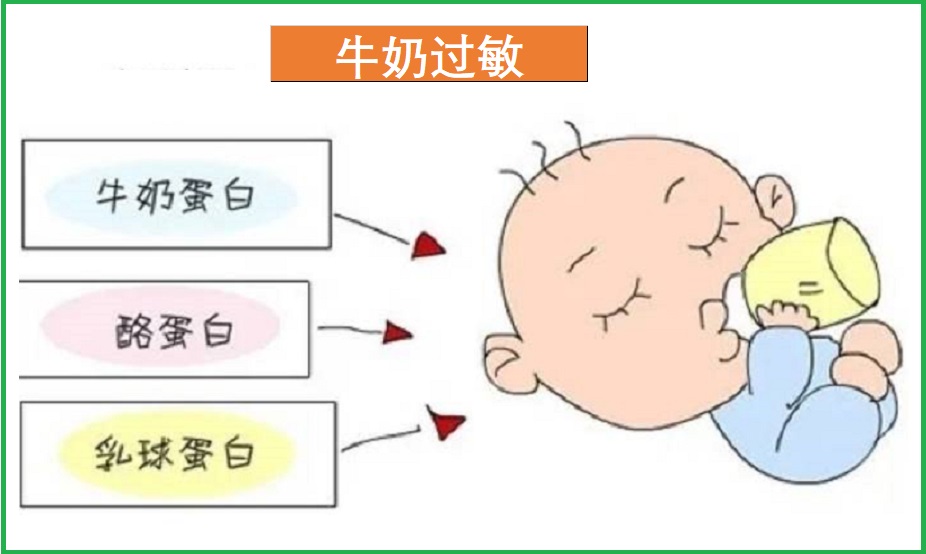  牛奶过敏