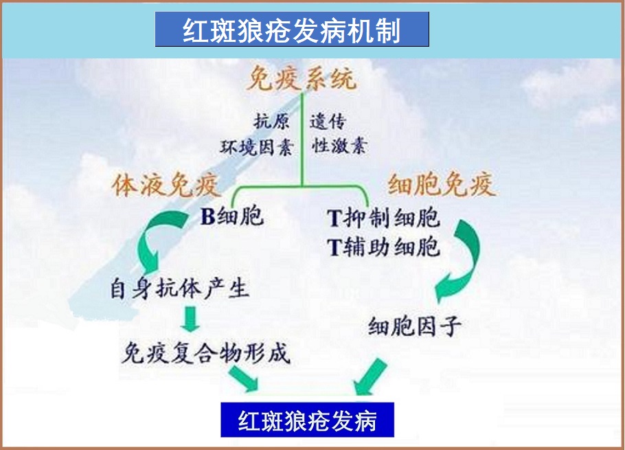  系统性红斑狼疮