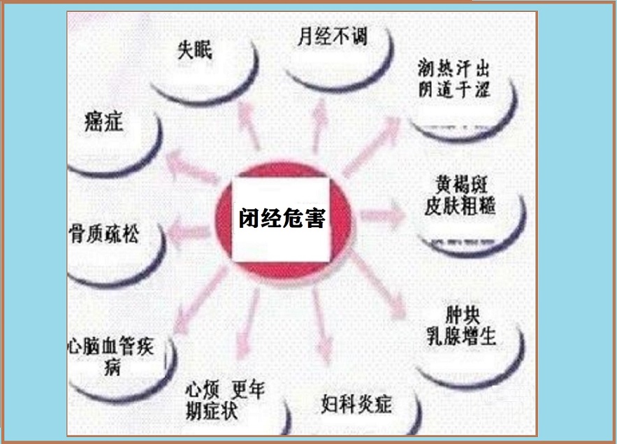  闭经