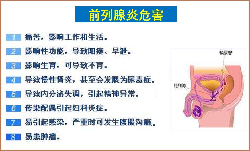  前列腺炎