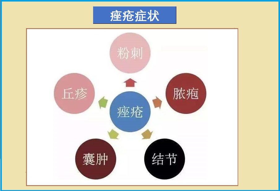  痤疮