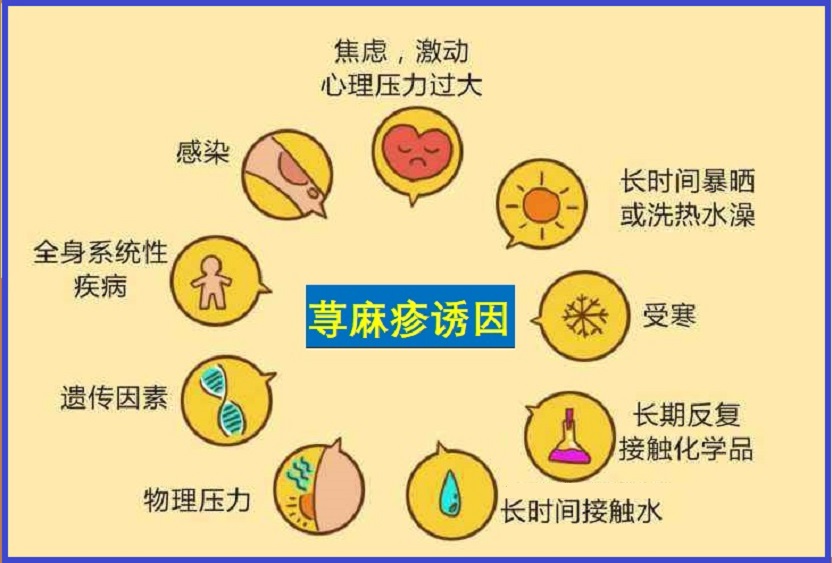 荨麻疹
