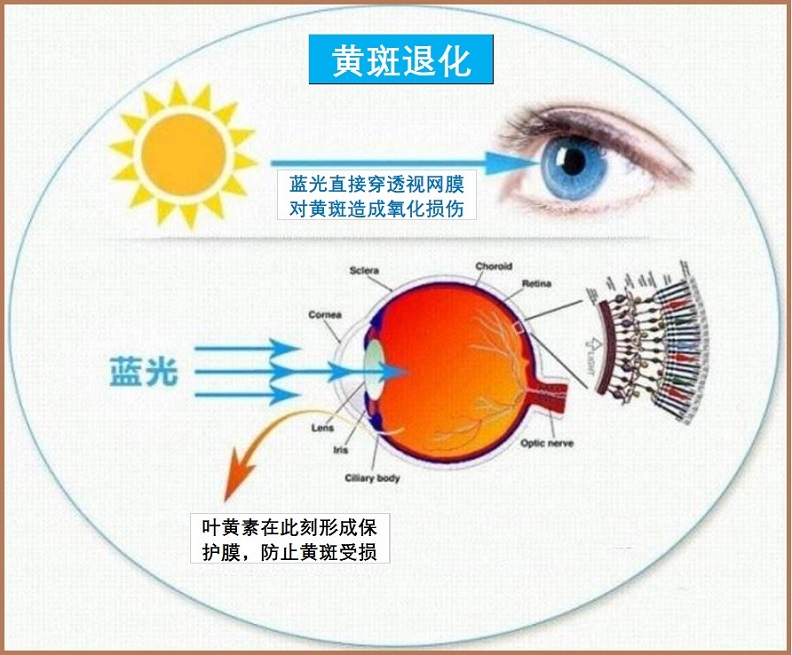  黄斑病变