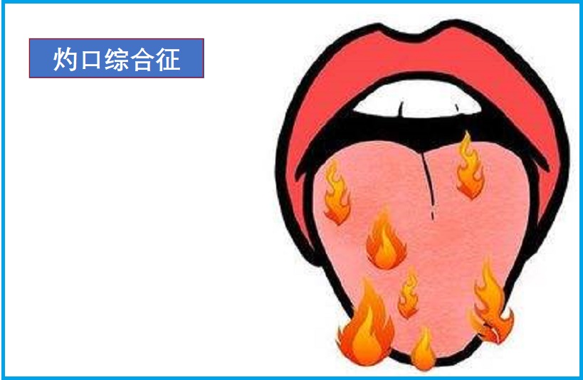  灼口综合征