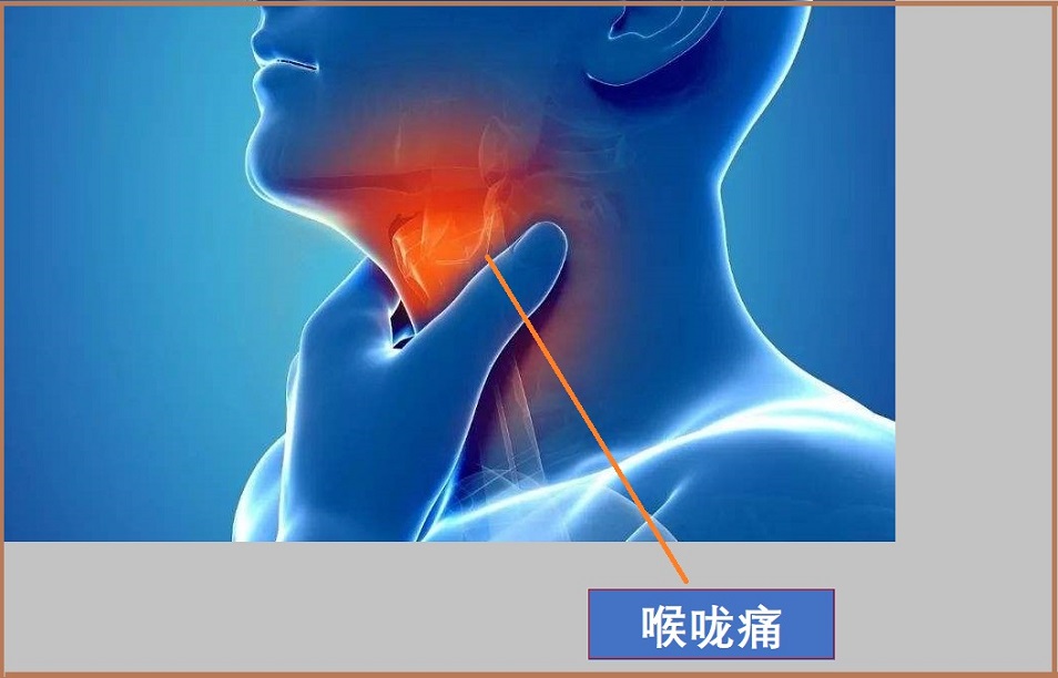  喉咙痛