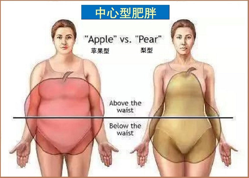  中心性肥胖管理