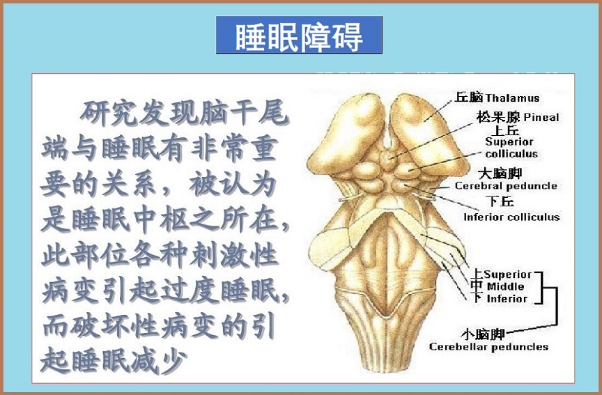 睡眠障碍