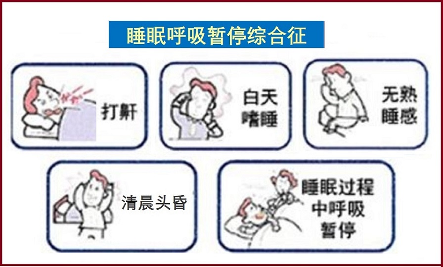  睡眠呼吸暂停