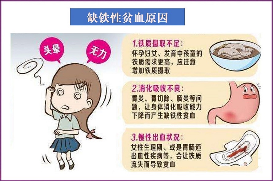  缺铁性贫血