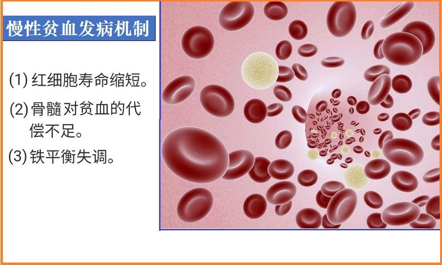  慢性病贫血