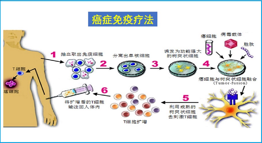  癌症免疫疗法