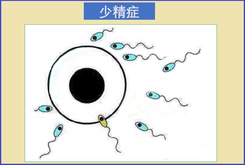  少精症