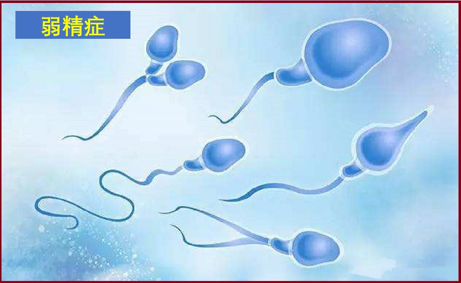  弱精子症
