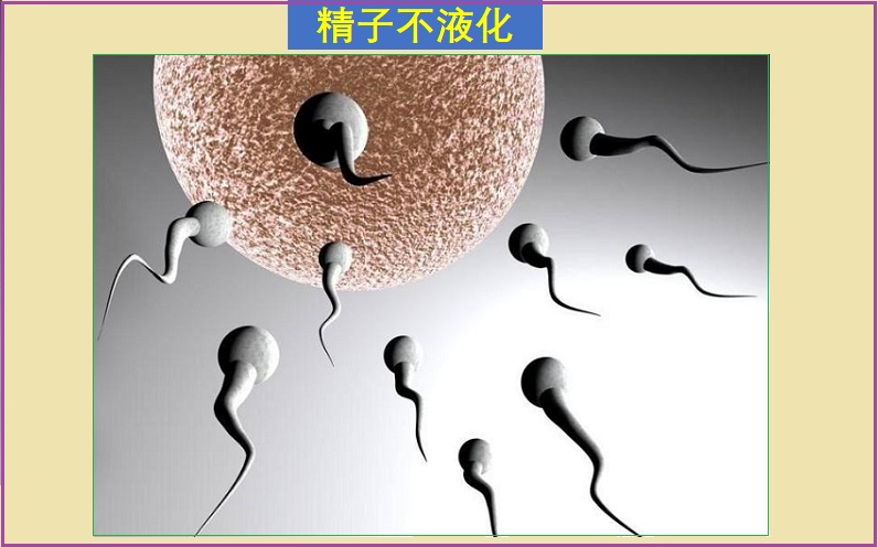  精液不液化