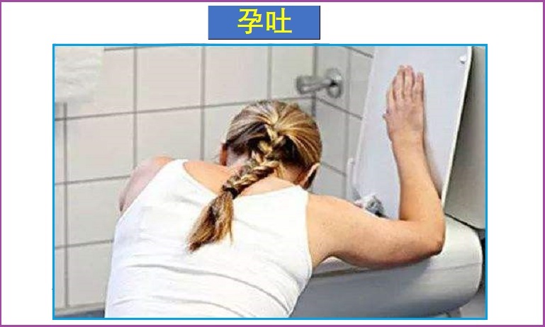  孕吐