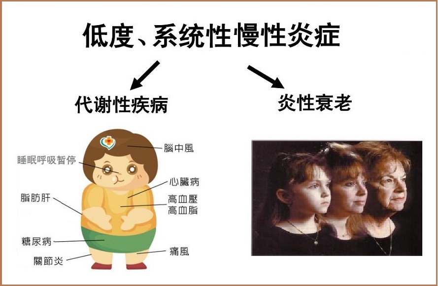  炎症与衰老